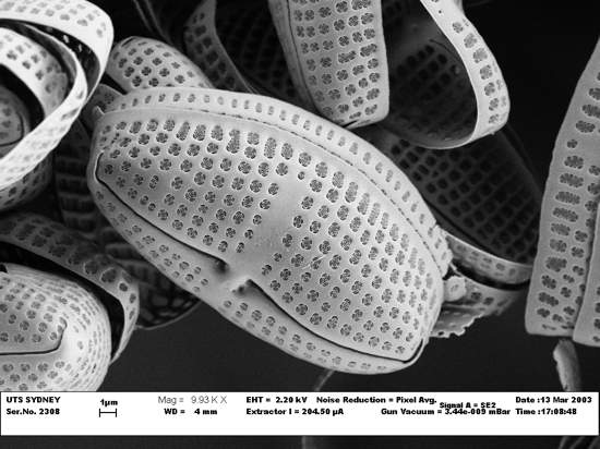 Scanning electron microscope image of a single species of diatoms showing the intricate design of the glass case that once held a living cell.  Image from: http://www.uts.edu.au/about/faculty-science/microstructural-analysis-unit/about-us  